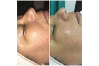 Inntus Le Femme Spa
